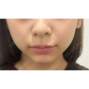 HAAB×DREAM BEAUTY CLINIC HAAB×DREAM BEAUTY CLINIC 東京本院口コミ