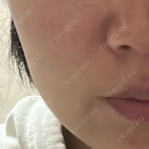 Zetith Beauty Clinic 福岡院口コミ