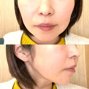椿クリニック 銀座TSUBAKIクリニック口コミ