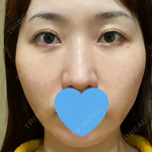 口コミ