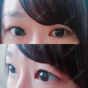 シエルクリニック口コミ