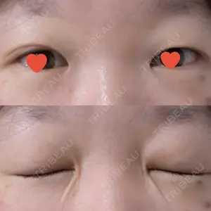 口コミ