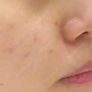 DAILY SKIN CLINIC DAILY SKIN CLINIC 心斎橋院口コミ