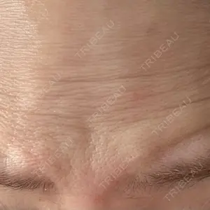 湘南美容クリニック 湘南美容クリニック 大阪梅田本院口コミ