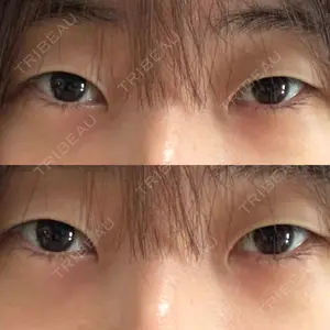 オーキッド美容クリニック東京御徒町口コミ