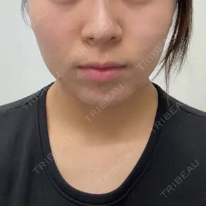 口コミ