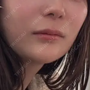 口コミ