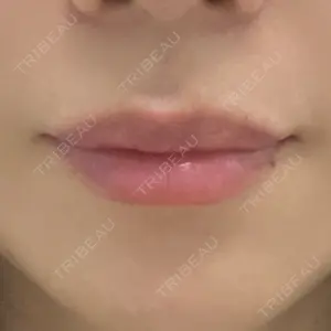 ルラ美容クリニック ルラ美容クリニック 名古屋本院口コミ