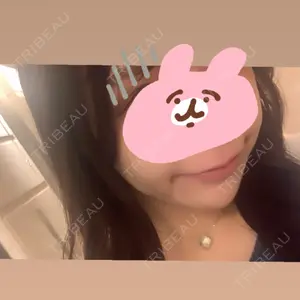 EMMO FACE CLINIC EMMO FACE CLINIC 大阪梅田院口コミ