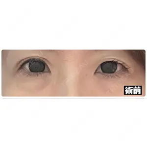 東京シンデレラ美容外科 東京シンデレラ美容外科 池袋院口コミ