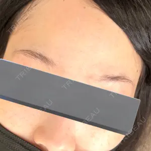 APスキンクリニック銀座口コミ