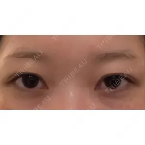 口コミ