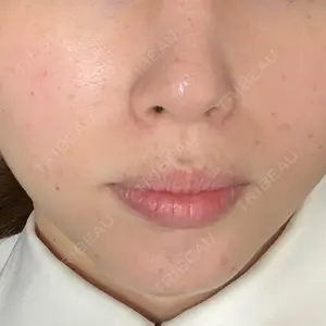 BIZENNクリニック【ビゼンクリニック】口コミ