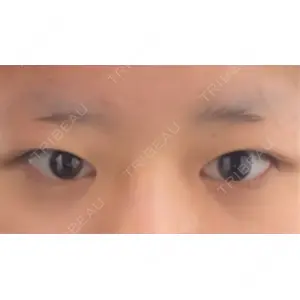 口コミ
