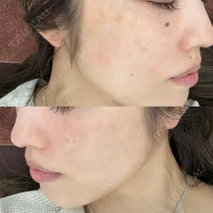 APスキンクリニック銀座口コミ