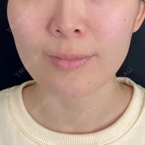藤・ナチュレ美容クリニック 藤・ナチュレ美容クリニック 銀座院口コミ