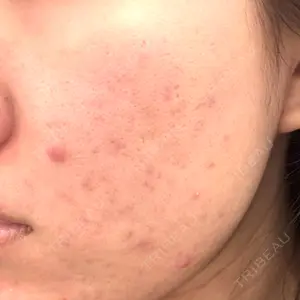 DAILY SKIN CLINIC DAILY SKIN CLINIC 福岡院口コミ