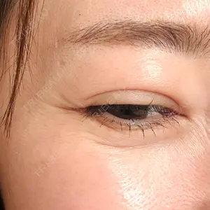 PRO CLINIC プロクリニック 銀座院口コミ