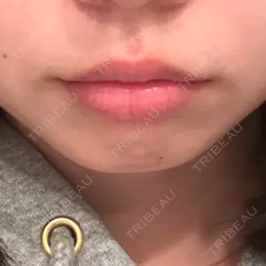 R Beauty CLINIC R Beauty CLINIC 銀座院口コミ