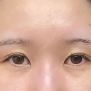 東京BELLEZZAクリニックの