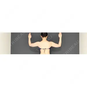 Lipo Clinic omotesando口コミ