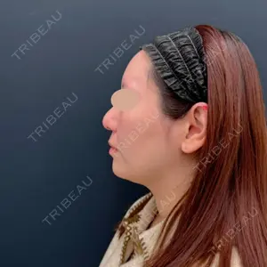 湘南美容クリニック 湘南美容クリニック 吉祥寺院口コミ