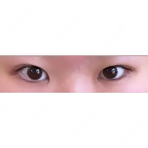東京シンデレラ美容外科 東京シンデレラ美容外科 池袋院口コミ