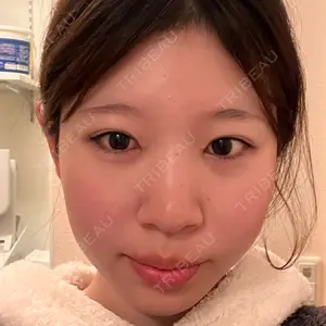 TCB東京中央美容外科 TCB東京中央美容外科 名古屋栄院口コミ