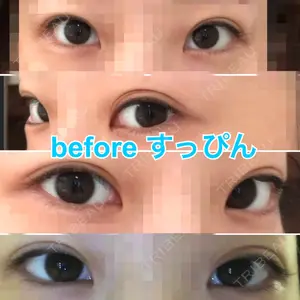 TCB東京中央美容外科 TCB東京中央美容外科 中野院口コミ