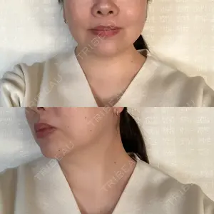 渋谷美容外科クリニック 渋谷美容外科クリニック 新橋院口コミ