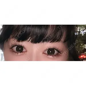 東京BELLEZZAクリニック口コミ