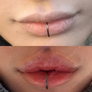 R Beauty CLINIC 銀座院の