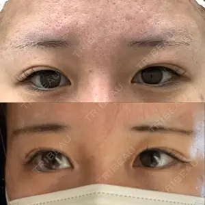 ルーチェクリニック ルーチェクリニック 銀座院口コミ