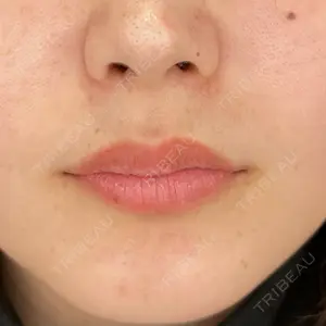 HAAB×DREAM BEAUTY CLINIC 大阪梅田院の