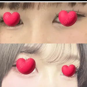 口コミ