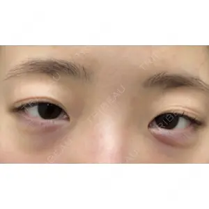 渋谷の森クリニック口コミ