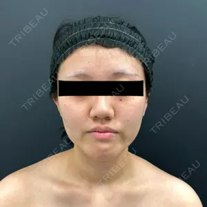 BLINC CLINIC （ブリンク クリニック）口コミ