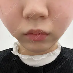 BBClinic BBClinic 銀座口コミ
