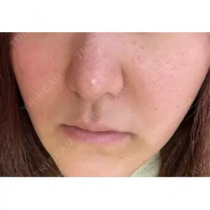 X CLINIC 恵比寿院口コミ