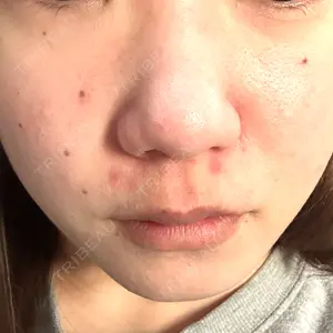 目白ホワイトクリニック口コミ