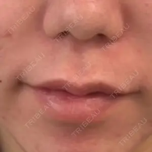 L‘amour clinic Tokyo【ラムールクリニック東京】口コミ