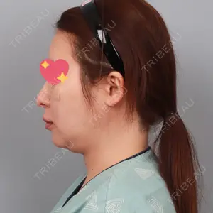 セギム美容整形外科口コミ