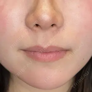 ルラ美容クリニック 上野院口コミ