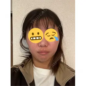 NARU Beauty Clinic 【ナルクリ】口コミ
