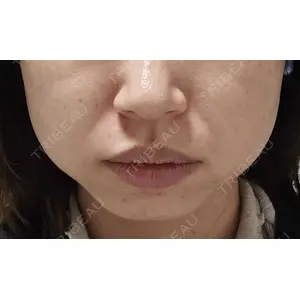 DMTC美容皮膚科 DMTC美容皮膚科 渋谷院口コミ