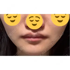 口コミ