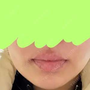 Re:anne clinic 銀座 【リアンクリニック銀座】口コミ