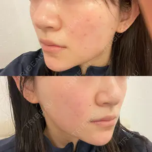 オラクル美容皮膚科 オラクル美容皮膚科 東京新宿院口コミ