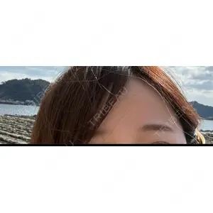 APスキンクリニック銀座口コミ