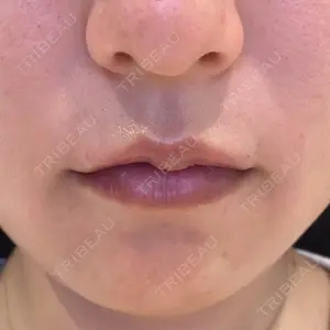 PRO CLINIC プロクリニック 銀座院口コミ